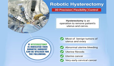 Robotic Hysterectomy Treatment